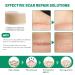 3 Rolls Silicone Scar Sheets - Reusable Scar Removal Strips for Prevention & Repair | Light Brown Silicone Scar Tape - Buy Online on GoSupps.com