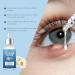 Stye Eye Treatment & Chalazion Remover | Eye Relief Serum & Gentle Lash Cleanser - Fast International Shipping - Buy Online on GoSupps.com