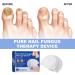 Fungus Laser Therapy Device Nail Fungus Laser Effective Nail Fungus Treatment For Toenails Discolored And Thickened Toenails (1PCS) - Buy Online on GoSupps.com