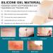 Silicone Scar Treatment Rollers - Heal C-Section Burns Keloids & Acne | 4cm x 320cm | Free Shipping Worldwide - Buy Online on GoSupps.com