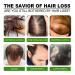 YUECI Nutrient Spray for Hair Growth - Hair Growth Serum & Anti-Hair Loss Treatment - Quick Thickening & Growth Solution (1ml) - Green - Buy Online on GoSupps.com