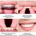 28 Piece Teeth Whitening Strips - Fast Stain Removal & Brightening for a Radiant Smile - Buy Online on GoSupps.com