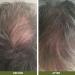 Australian Bodycare Hair loss Shampoo 250ml | Ideal for anyone experiencing hair loss or has very fine thin hair | Stimulates hair growth Great for slow growing hair For Men and Women 250 ml (Pack of 1) - Buy Online on GoSupps.com