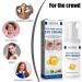 DGUSO Jasmine Cream Against Dark Circles and Saggy Eyelids Active Jasmine Cream Against Tear Bags Jasmine Eye Cream Against Wrinkles Collagen Aloe Vera Extract Eye Cream - Buy Online on GoSupps.com