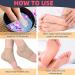 Cracked Heel Treatment Repair Socks - Premium Padded Compression Gel Sleeves for Dry Feet - 2 Pairs Spa Moisturizing Socks (One Size Fits Most - Buy Online on GoSupps.com