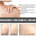 Bedsor_e Wound Care Cream SOR_ess Relief Healing Cream 20g Bedsor_e Ointment for Fast Healing Soothing Relief of Bed SOR_ess Chafed Skin Hard-to-Heal Skin SOR_ess Wound Healing - Buy Online on GoSupps.com