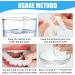 Frenzify Tooth Bleaching Set - Cosmetic Teeth Lightening with Top & Bottom Veneers Box & Pincers for Bad Teeth - International Shipping Available - Buy Online on GoSupps.com