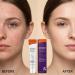 Cr me hydratante pour le visage | Gel hydratant non gras pour le visage | Cr me anti-boutons pour le corps | Pour hommes femmes adolescents voyages maison - Buy Online on GoSupps.com