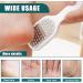 Stainless Steel Heel Scraper for Cracked Heels Foot Grater Callus Remover for Foot Care (2) - Buy Online on GoSupps.com
