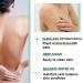 Herbaluxy Back Acne Treatment Spray - 2% Salicylic Acid for Effective Body Acne Relief | Fast International Shipping - Buy Online on GoSupps.com