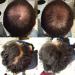 Nor1 Keratin Hair Building Fibers 25g Light Blonde - Hair Fiber Filler for Thinning Hair - Men and Women Concealer - Fuller Hair in Seconds - Buy Online on GoSupps.com