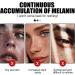 Trendyfave Facial Brightening Serum Face Moisturiser Hydrating Serum Face Serum for Women & Men Face Serum With Hyaluronic acid Squalane Shea Butter and Vitamin E Serum for Face Care - Buy Online on GoSupps.com