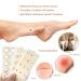 Soft Foam Corn Pads - 45PCS U-Shaped Callus Cushions with Self Stick Adhesive for Toe and Foot Care - Buy Online on GoSupps.com