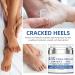 45% Urea Foot Cream - Moisturizing Cracked Heel Repair Cream for Feet and Hand - Callus Remover for Cracked Heels and Dry Skin Rough Skin - Hard Skin Remover for Hand and Foot Care - Buy Online on GoSupps.com