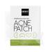 Hydrocolloid Large Acne Patches for Cheek & Chin - 80 Pieces - Extra coverage For Breakout Conceals Acne Reduces Pimples and Blackheads