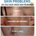 Acne Serum With Plant-Based Formula Dark Spot Correcting Glow Serum Dark Spot Serum Brightening Serum Hydrating Serum Improve Redness And Blemishes Smoothing & Calming Suitable For All Skin Types - Buy Online on GoSupps.com