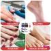 Qianyu 81 Piece Sanding Sleeves Sanding Caps Set Professional Nail Cutter Attachment Nail Sanding Bit Fine Grain Coarse Sanding Belts with Mandrel Bit for Manicure Pedicure White Black Purple Pink - Buy Online on GoSupps.com