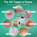 Silicone Scar Sheets - Medical Grade Surgical Strips for Scars Removal - Adhesive Bandage Patches for Acne, C-Section, Burn, Keloid, Tummy Tuck - 1.6 x 120 - Buy Online on GoSupps.com
