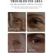 Retinol Eye Cream - Eye Cream for Dark Circles and Puffy Eyes - Under Eye Cream Anti Aging - Reduce Fine Line Smooth Tender Fade Wrinkle - Moisture Hydrate Skin Firm Lift Elasticity Restore Radiance - Buy Online on GoSupps.com