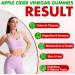 Apple Cider Vinegar Gummies Advanced ACV Gummy with Probiotics BHB B12 and Keto Support - Keto Acv Gummies for Detox Metabolism Digestion Gut & Immune Health - Sugar Free Vegan 180 Counts 180 Count (Pack of 1) - Buy Online on GoSupps.com