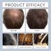 S rum capillaire en rouleau S rum nourrissant pour des cheveux plus pais et plus forts r duit la chute des cheveux r pare les dommages am liore la brillance formule anti-chute (2pcs) - Buy Online on GoSupps.com