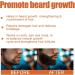 Botiniv Men's Beard Oil - Jojoba Oil Formula for Beard Growth & Care | Softens & Strengthens Facial Hair - 1.05 fl oz - Buy Online on GoSupps.com