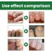 S rum pour ongles - 30 ml x 2 - Huile nourrissante pour les ongles et les cuticules - Traitement des ongles incarn s - Pour ongles craquel s rugueux cassants et fendus - Buy Online on GoSupps.com