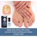 Onyxoguard Nail Growth and Repair Serum Onyxoguard Nail Repair Serum Nail Strengthener for Damaged Nails Nail Strengthening and Growth Conditioner Nail Repair Treatment Nail Strengthener Polish - Buy Online on GoSupps.com
