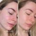 REN Clean Skincare Glow Tonic 16.9 Fl Oz - Daily Facial Brightening Exfoliant with AHAs & BHAs - Cruelty Free & Vegan Pore Reducing Toner - Buy Online on GoSupps.com