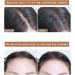 ONLYOILY Hairline Powder for Instant Root Touch Up & Hair Dye - Perfect for Cosmetic Quick Fixes & Makeup Removal Facial Suitable for All Hair Types 04 - Buy Online on GoSupps.com