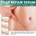 ScarRevita Advanced Repair Serum - Scar Removal Spray for All Skin Types (1PC) - Buy Online on GoSupps.com