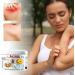 Itch Relief Cream | 30g Itch Relief Lotion Rash Cream | Rash Cream External Ointment Relieve Itchy Skin Redness Cream for Women Menb - Buy Online on GoSupps.com