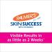 Palmers Skin Success Anti-Dark Spot Fade Cream with Vitamin E and Niacinamide - 4.4oz | Reduce Dark & Age Spots | For All Skin Types - Buy Online on GoSupps.com