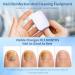 Nail Fungus Cleaning Light Device - Effective Rechargeable Remedy for Damaged Discolored Toenails & Fingernails - Fast Shipping Worldwide - Buy Online on GoSupps.com