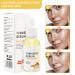 2023 New Turmeric Dark Spot Corrector Serum for Hyperpigmentation & Age Spots - Skin Care Moisturizing Repair Essence for Men & Women - Buy Online on GoSupps.com