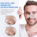 Tiuedu Blackhead Pore Strips - 70PCS Charcoal Nose Strips for Deep Cleansing & Instant Blackhead Removal | Natural Pore Cleaner for Men - Buy Online on GoSupps.com