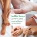 40% Urea Foot Cream - Moisturizing Urea Cream for Very Dry Feet - Cracked Heel Repair Cream for Foot Care - Heel Cream for Deep Cracked Skin - Feet Cream for Calluses and Hard Skin - Buy Online on GoSupps.com
