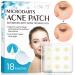 Jonov Acne Pimple Patch  Fast Acting Anti-Acne Hydrocolloid Pimple Patches for Night  Acne Spot Healing Blemish Patch Zit Patches for Face  Blemish Patches Cover Patches Stickers (18 Patches)