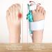 Adjustable Bunion Splint & Hallux Valgus Corrector | Orthopedic Toe Straightener - Green & White | International Shipping Available - Buy Online on GoSupps.com
