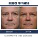 OPENEYES Awaken Peptide Lifting Eye Gel Openeyes Peptide Eye Gel Open Eyes Peptide Openeyes Lifting Eye Gel Men Eye Cream for Dark Circles and Puffiness (4Pcs) - Buy Online on GoSupps.com