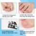 70PCS Ingrown Toenail Treatment Kit for Effective Pain Relief - Breathable Plastic Tool for Paronychia Patients - Buy Online on GoSupps.com