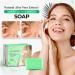Genryu Aloe Vera Wart Eliminator Soap 100g (2 PC) - Sulfate Free, Ultra Moisturising - Buy Online on GoSupps.com