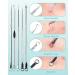 EZBASICS Blackhead Remover Tools - Stainless Steel Comedone Extractor Set for Blemish and Whitehead Popping - Buy Online on GoSupps.com