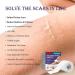 Silicone Scar Tape Roll - Professional Reusable Sheets for Surgical Caesarean Scar Removal - Buy Online on GoSupps.com