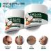 40% Urea Cream for Feet - Ultra Moisturizing Repair Treatment for Dry Cracked Heels & Calluses with 2% Salicylic Acid - Softens & Exfoliates Hands Knees Elbows - Buy Online on GoSupps.com