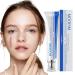 Scar Cream Scar Removal Cream Advanced Scar Treatment For Face and Body Repair Scar Cream for Keloid C-Section Surgery Burns Acne Etc Old and New Scars Scar Removal for Women 30g / 1.06 fl oz