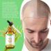 Essential Oil Rice Bran Oil for Hair 2.02fl.oz Pure Rice Bran Oil with Antioxidant Action Beard Eyebrows and Eyelash Growth for Hair Strengthening (Serum-60ml) - Buy Online on GoSupps.com