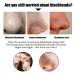 2PCS Nose Pore Strips - Blackhead Remover & Deep Cleansing Peel Off Strips for All Skin Types - Buy Online on GoSupps.com