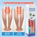 3Pcs Varicose Veins Treatment Set - Heal Veins, Improve Circulation - 90ml Spray - Buy Online on GoSupps.com