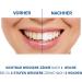 Perlweiss Expert Weiss Toothpaste - Effective Teeth Cleaning & Whitening | 4 Levels Whiter in 3 Weeks | With Perlit (50 ml) - International Shipping - Buy Online on GoSupps.com